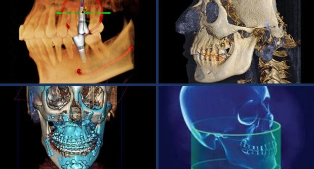 Xray of a jaw