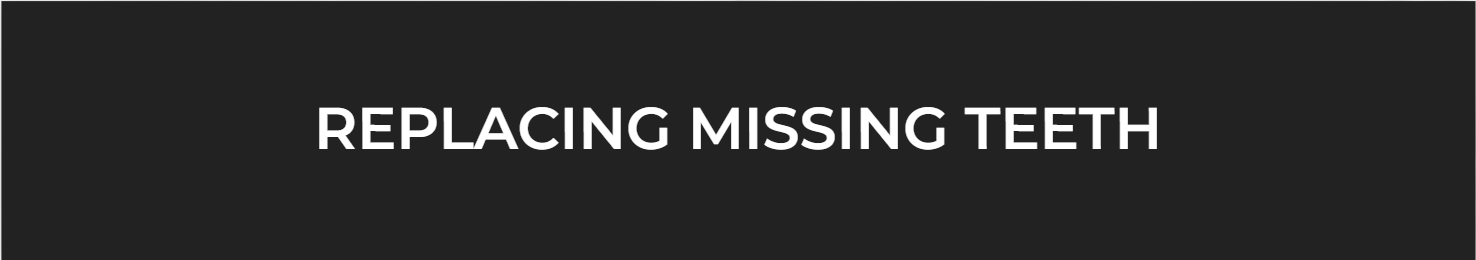 Replacing Missing Teeth