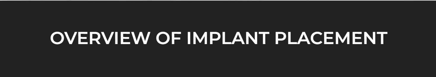 Overview Of Implant Placement