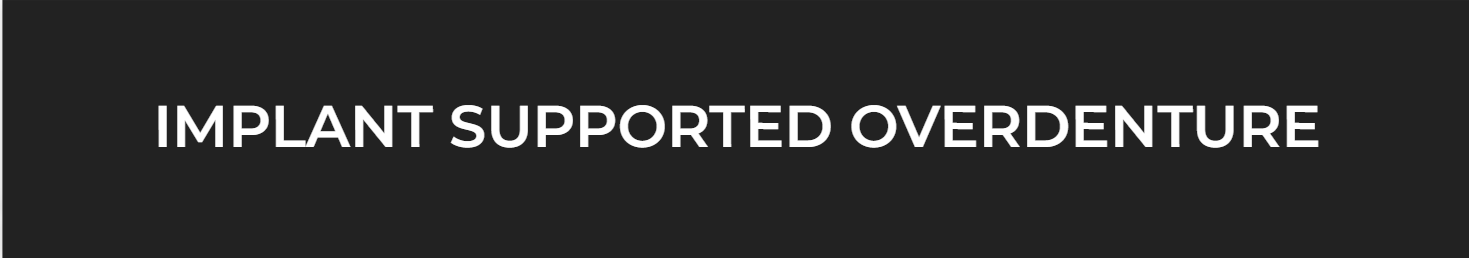 Implant supported overdentrue