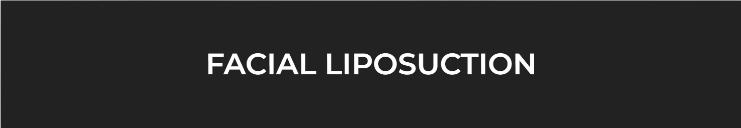facial liposuction